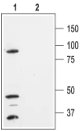Anti-KCNK1 antibody used in Western Blot (WB). GTX16685
