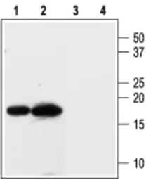 Anti-KCNE3 antibody used in Western Blot (WB). GTX16690