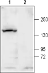 Anti-KCNT1 antibody used in Western Blot (WB). GTX16697
