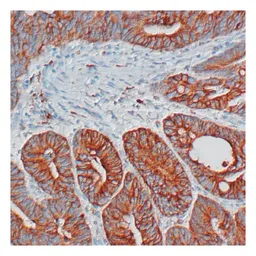 Anti-COX2 antibody [SP21] used in IHC (Paraffin sections) (IHC-P). GTX16701