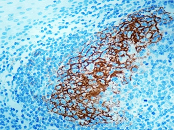 Anti-CD23 antibody [SP23] used in IHC (Paraffin sections) (IHC-P). GTX16702