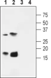 Anti-KCNE4 antibody used in Western Blot (WB). GTX16707