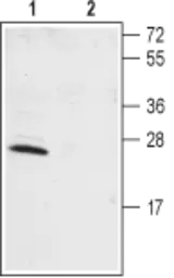 Anti-KCNIP1 antibody used in Western Blot (WB). GTX16713