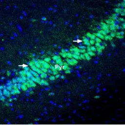 Anti-KChIP2 antibody used in IHC (Frozen sections) (IHC-Fr). GTX16714