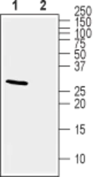 Anti-KChIP2 antibody used in Western Blot (WB). GTX16714