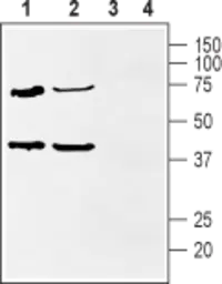 Anti-KChIP2 antibody used in Western Blot (WB). GTX16714