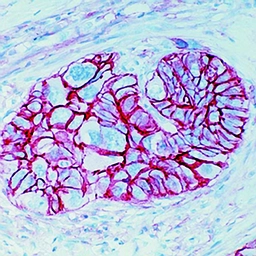 Anti-CD44 antibody [156-3C11] used in IHC (Paraffin sections) (IHC-P). GTX16728