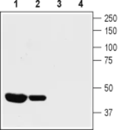 Anti-KCNA10 antibody used in Western Blot (WB). GTX16755