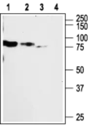Anti-P2X2 antibody used in Western Blot (WB). GTX16789