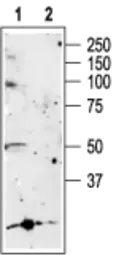 Anti-P2X5 antibody used in Western Blot (WB). GTX16812