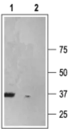 Anti-P2X6 antibody used in Western Blot (WB). GTX16843