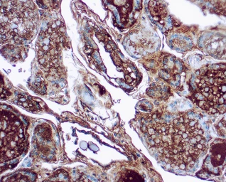 Anti-Thyroglobulin antibody [1D4] used in IHC (Paraffin sections) (IHC-P). GTX16853