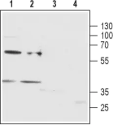 Anti-P2Y12 antibody used in Western Blot (WB). GTX16888