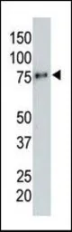 Anti-HA tag antibody [12CA5] used in Western Blot (WB). GTX16918