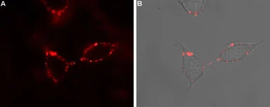Anti-P2Y1 antibody used in Live cell imaging (LCI). GTX16924