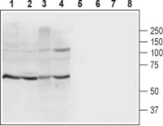 Anti-P2X4 antibody used in Western Blot (WB). GTX16929