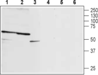 Anti-P2X2 antibody used in Western Blot (WB). GTX16933