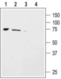 Anti-ACCN4 antibody used in Western Blot (WB). GTX16957