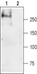 Anti-SCN4A antibody used in Western Blot (WB). GTX16970