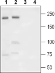Anti-Nav1.7 antibody used in Western Blot (WB). GTX16971