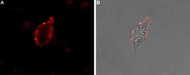 Anti-Nav1.7 antibody used in Live cell imaging (LCI). GTX16971