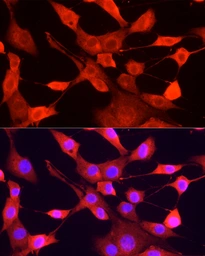Anti-ULK1 antibody used in Immunocytochemistry/ Immunofluorescence (ICC/IF). GTX16974
