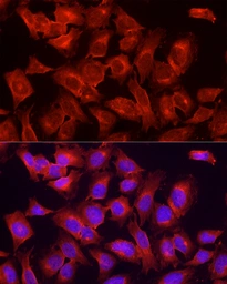 Anti-ULK1 antibody used in Immunocytochemistry/ Immunofluorescence (ICC/IF). GTX16974