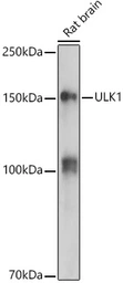 Anti-ULK1 antibody used in Western Blot (WB). GTX16974