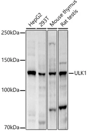 Anti-ULK1 antibody used in Western Blot (WB). GTX16974
