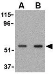 Anti-SnoN antibody used in Western Blot (WB). GTX16977