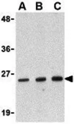 Anti-DEDD2 antibody used in Western Blot (WB). GTX16979