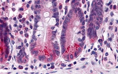 Anti-BIRC6 antibody used in IHC (Paraffin sections) (IHC-P). GTX16980