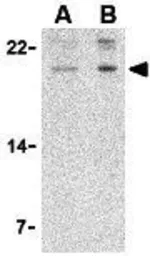 Anti-AES antibody used in Western Blot (WB). GTX16983