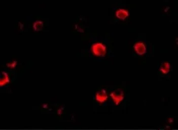 Anti-AES antibody used in Immunocytochemistry/ Immunofluorescence (ICC/IF). GTX16983