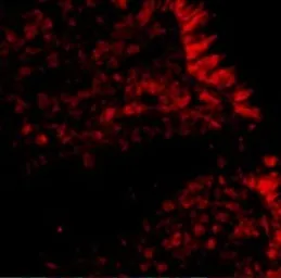 Anti-MICA antibody used in IHC (Paraffin sections) (IHC-P). GTX16991