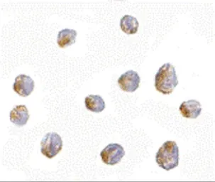 Anti-LIS1 antibody used in Immunocytochemistry/ Immunofluorescence (ICC/IF). GTX16993