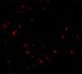 Anti-LIS1 antibody used in Immunocytochemistry/ Immunofluorescence (ICC/IF). GTX16993