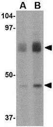 Anti-DHX58 antibody used in Western Blot (WB). GTX16996