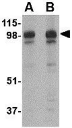Anti-SLITRK2 antibody used in Western Blot (WB). GTX16999