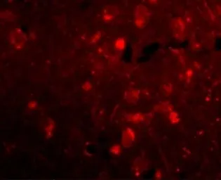 Anti-SLITRK2 antibody used in IHC (Paraffin sections) (IHC-P). GTX16999