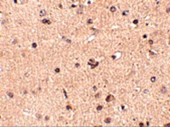 Anti-SLITRK2 antibody used in IHC (Paraffin sections) (IHC-P). GTX16999