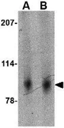 Anti-SLITRK2 antibody used in Western Blot (WB). GTX17000