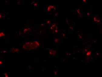 Anti-SLITRK2 antibody used in IHC (Paraffin sections) (IHC-P). GTX17000