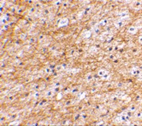 Anti-AIFM3 antibody used in IHC (Paraffin sections) (IHC-P). GTX17001