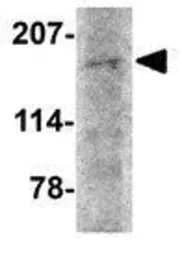 Anti-AMBRA1 antibody used in Western Blot (WB). GTX17004