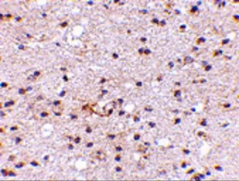 Anti-AMBRA1 antibody used in IHC (Paraffin sections) (IHC-P). GTX17004