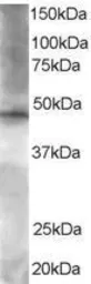 Anti-BRF2 antibody, C-term used in Western Blot (WB). GTX17011