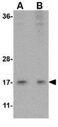 Anti-HINT1 antibody used in Western Blot (WB). GTX17017