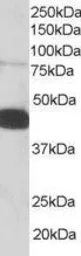 Anti-Pleckstrin antibody, C-term used in Western Blot (WB). GTX17020