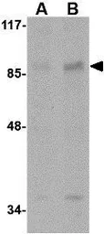 Anti-AAK1 antibody used in Western Blot (WB). GTX17021